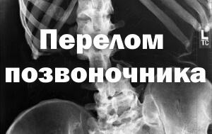 Повреждение Рентген