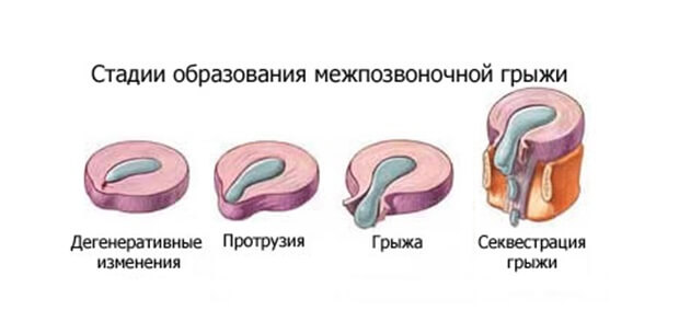 Как выглядит Секвестрированная
