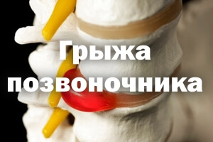 Появилась проблема Эта проблема