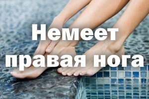 Немеет правая ножка Немеет правая нога