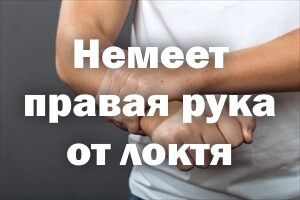 Онемела правая рука от локтя Немеет правая рука от локтя