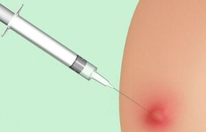 Появилась шишка Шишка