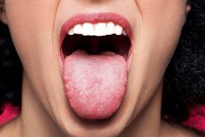 Проблемы у человека с языком