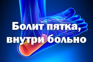Болит пятка, внутри больно Болит пяточка, внутри больно