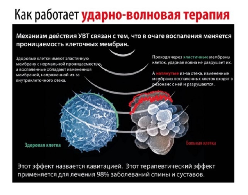 Как работает УВТ Как работает аппарат для УВТ