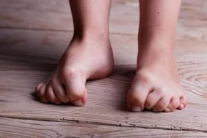 Ребенок подгибает пальцы Ребенок подгибает пальчики