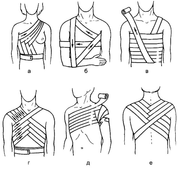 Перевязываем Повязка