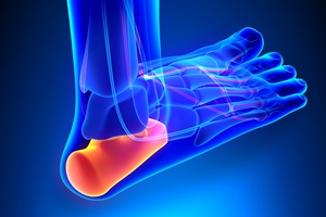 Рентгеновский снимок пятки Рентгеновский снимок пяточки