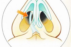 Рисунок носа Рисунок носика