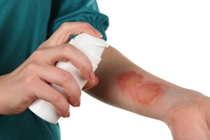 Исцеляем Исцеление