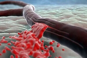 Артерия Аорта