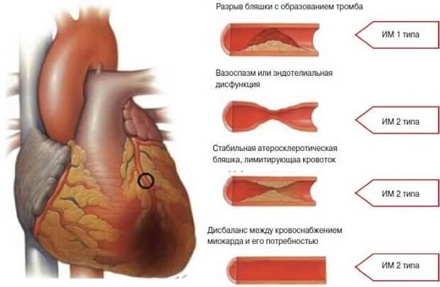 Какой бывает Виды