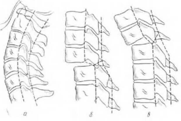 Какие бывают Виды