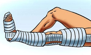 Шина на ножку Шина на ногу