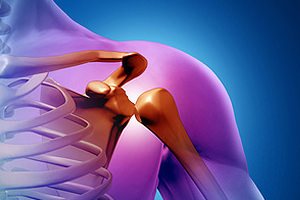 Сломанное плечико Поломанное плечико