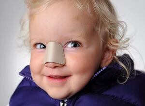 Сломанный нос у ребенка