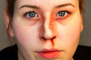 Сломанный носик Поломанный носик