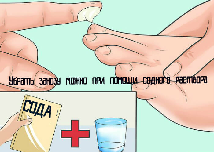 Поменять Сода