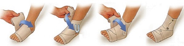 Поменять Перевязка ноги