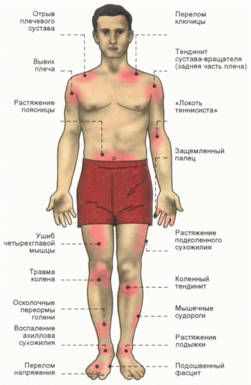 Виды Список повреждений