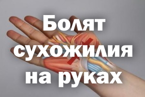 Болят сухожилия на руках Болят сухожилия на ручках