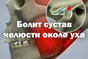 Болит сустав челюсти около уха Болит челюсть около уха
