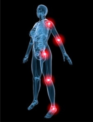 Спазм Мышечный спазм