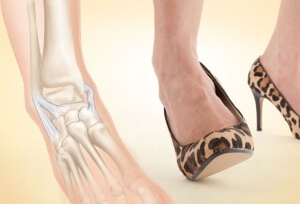 Каблуки Ношение обуви