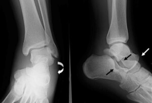 Обследование Рентген