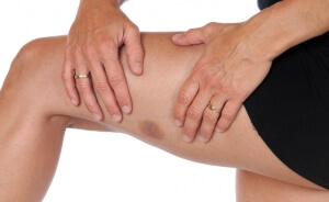 Нога У взрослого