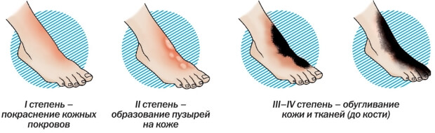 Разные степени Степени