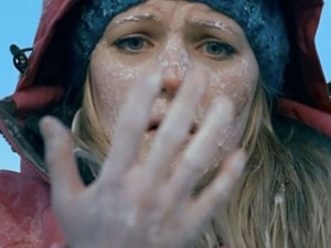 Холод Обморожение