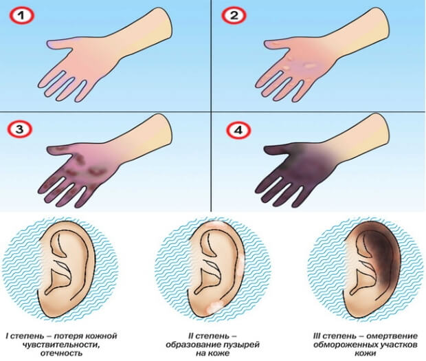 Какие бывают Степени