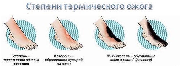 Какие бывают Различные степени