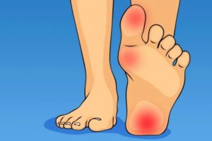 Точка на пятке Точка на пяточке