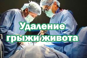 Удаление грыжи живота Иссечение грыжи живота