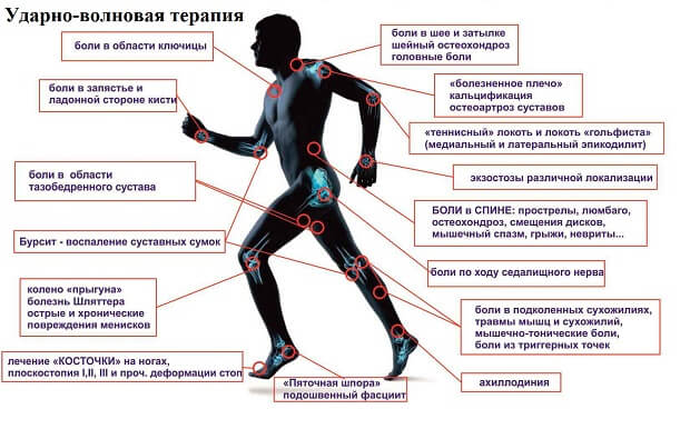 Когда требуется Когда советуют