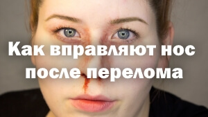 Репозиция Повреждение